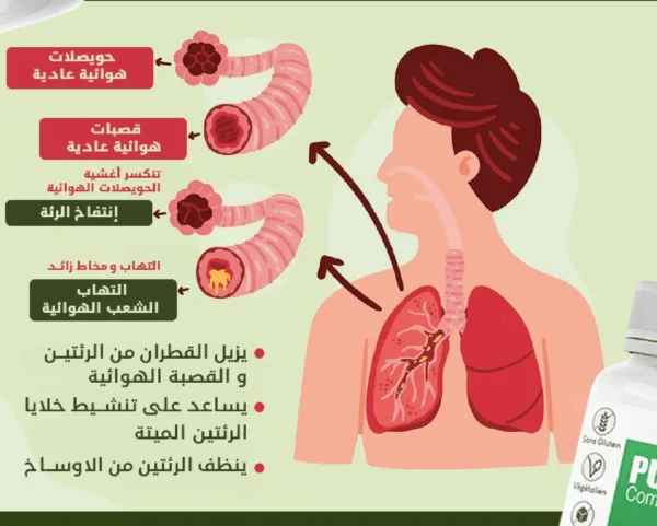 Capsule Désintoxication Poumon au Maroc – Image 4