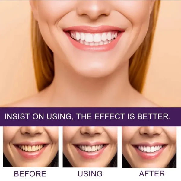 ⁦Dentifrice Blanchissant Violet au Maroc⁩ - الصورة ⁦7⁩