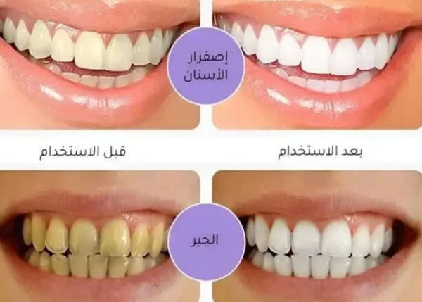 Dentifrice Violet au Maroc