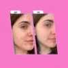 PATCHS VISAGE ANTI au Maroc